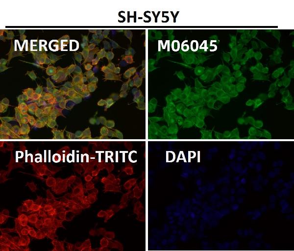 1 - Anti-HoxC6 Rabbit Monoclonal Antibody ABO16670