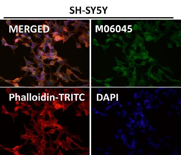 1 - Anti-HoxC6 Rabbit Monoclonal Antibody ABO16670