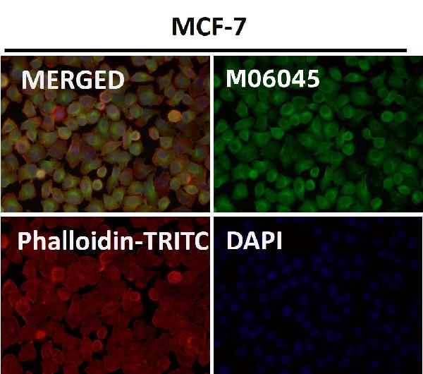 1 - Anti-HoxC6 Rabbit Monoclonal Antibody ABO16670