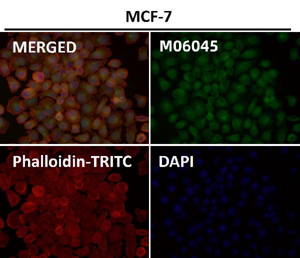 1 - Anti-HoxC6 Rabbit Monoclonal Antibody ABO16670