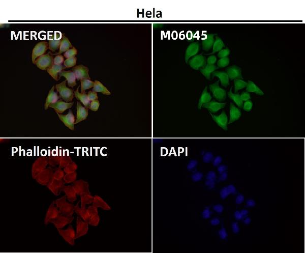 1 - Anti-HoxC6 Rabbit Monoclonal Antibody ABO16670