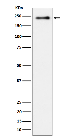 1 - Anti-Phospho-LRP6 (S1490) Rabbit Monoclonal Antibody ABO16671