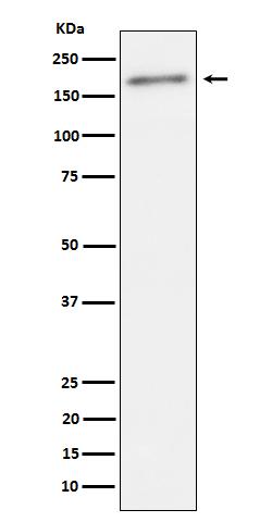 1 - Anti-Phospho-ErbB2(Y1221 + Y1222) Rabbit Monoclonal Antibody ABO16672