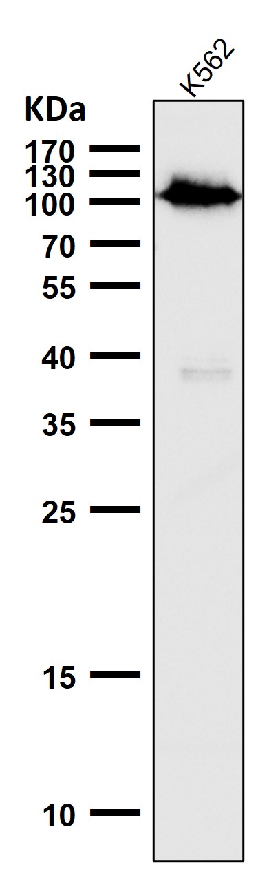 1 - Anti-Phospho-Rb (S780) Rabbit Monoclonal Antibody ABO16673