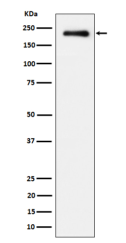 1 - Anti-Phospho-EGFR (Y845) Rabbit Monoclonal Antibody ABO16674