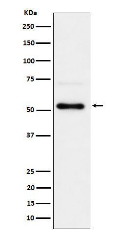 1 - Anti-Phospho-Chk1 (S280) Rabbit Monoclonal Antibody ABO16675
