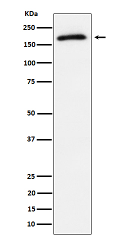 1 - Anti-Phospho-AS160 (T642) Rabbit Monoclonal Antibody ABO16676