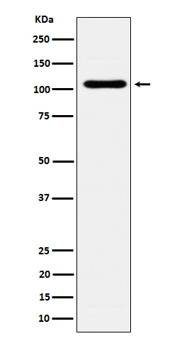 1 - Anti-EXOC2 Rabbit Monoclonal Antibody ABO16678