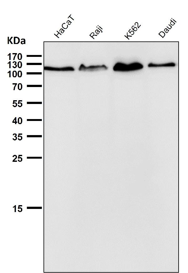 1 - Anti-EXOC2 Rabbit Monoclonal Antibody ABO16678