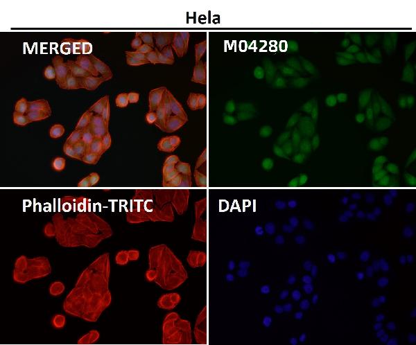 1 - Anti-DUT Rabbit Monoclonal Antibody ABO16679