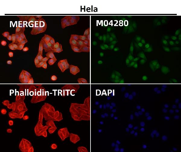 1 - Anti-DUT Rabbit Monoclonal Antibody ABO16679