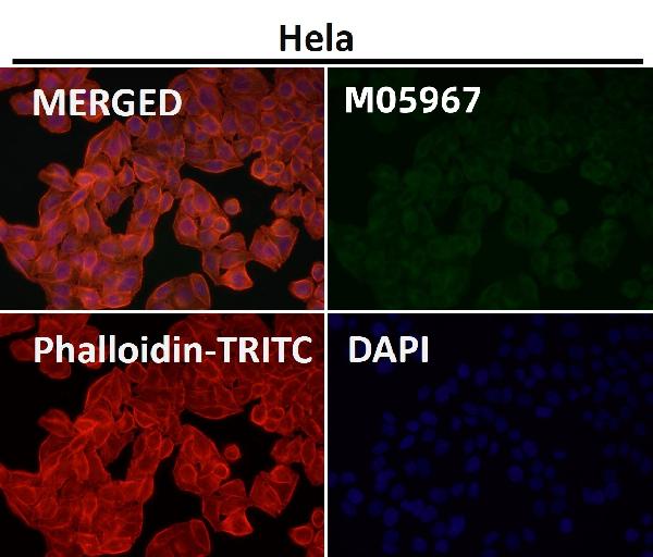 1 - Anti-RAB22A Rabbit Monoclonal Antibody ABO16680