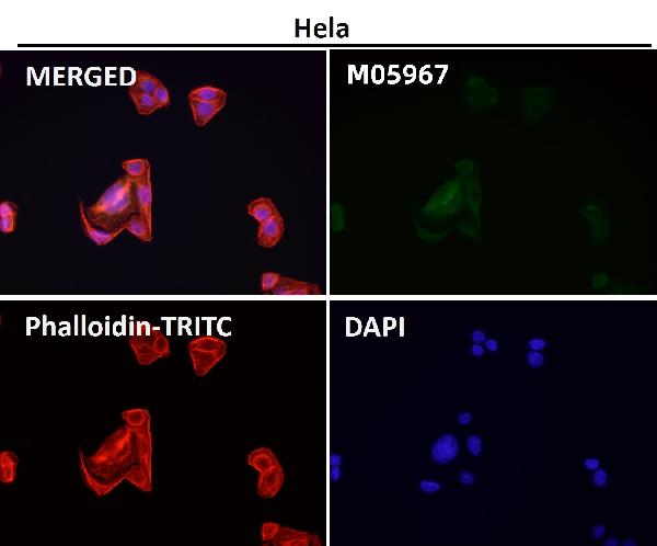 1 - Anti-RAB22A Rabbit Monoclonal Antibody ABO16680