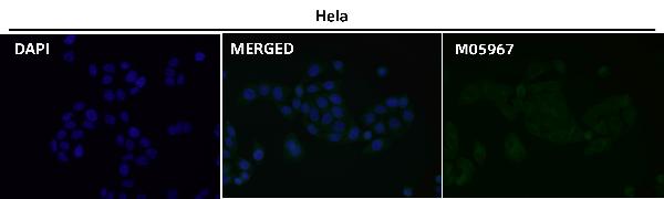 1 - Anti-RAB22A Rabbit Monoclonal Antibody ABO16680