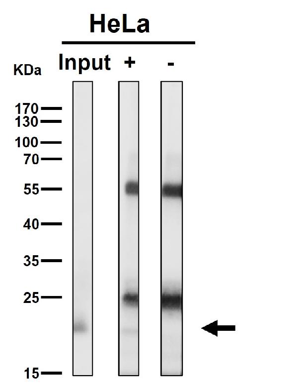 1 - Anti-RAB22A Rabbit Monoclonal Antibody ABO16680