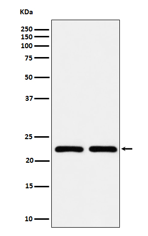1 - Anti-RAB22A Rabbit Monoclonal Antibody ABO16680