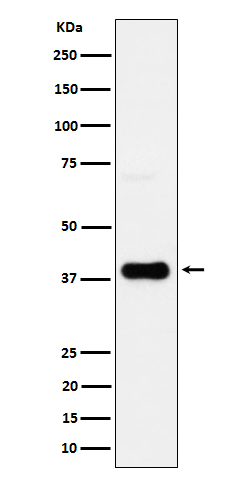 1 - Anti-CXCR6 / CD186 Rabbit Monoclonal Antibody ABO16681