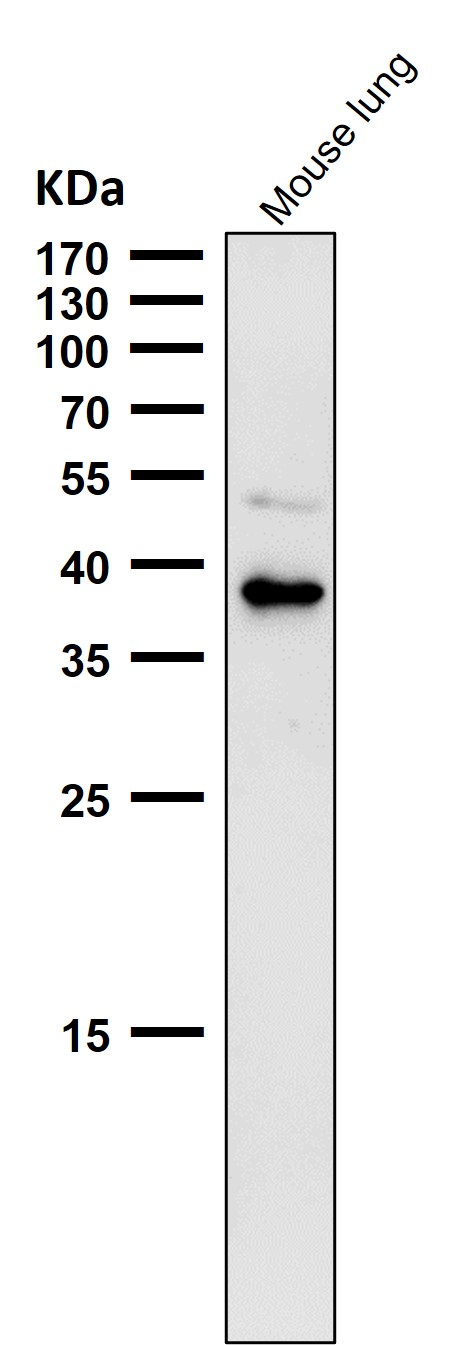1 - Anti-CXCR6 / CD186 Rabbit Monoclonal Antibody ABO16681