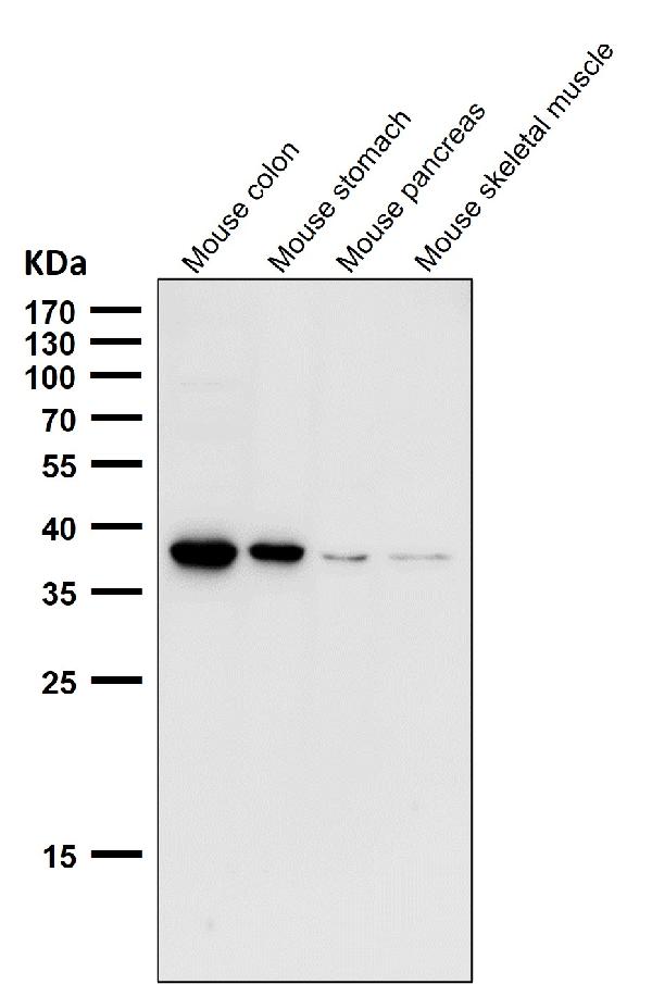 1 - Anti-CXCR6 / CD186 Rabbit Monoclonal Antibody ABO16681