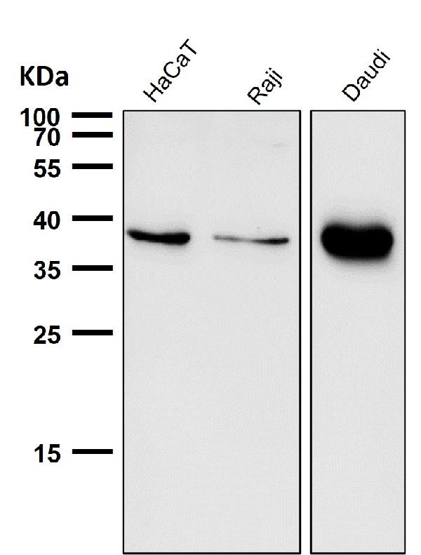 1 - Anti-CXCR6 / CD186 Rabbit Monoclonal Antibody ABO16681