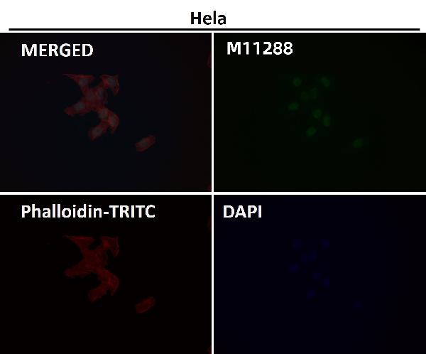 1 - Anti-TFIIE alpha Rabbit Monoclonal Antibody ABO16682