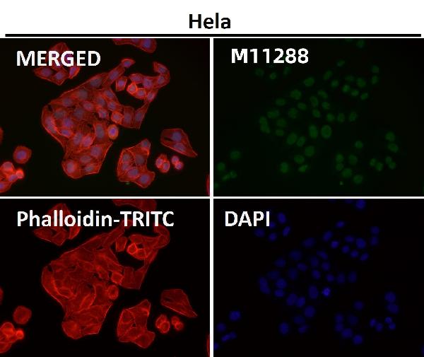 1 - Anti-TFIIE alpha Rabbit Monoclonal Antibody ABO16682