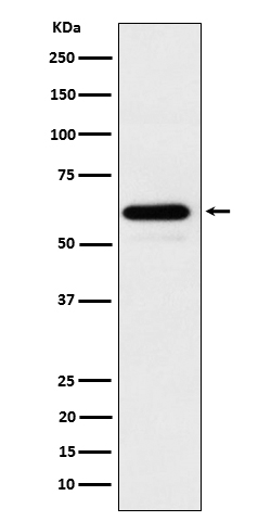 1 - Anti-HRPT2 / CDC73 Rabbit Monoclonal Antibody ABO16683
