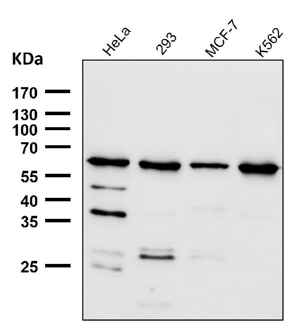 1 - Anti-HRPT2 / CDC73 Rabbit Monoclonal Antibody ABO16683