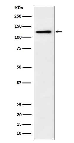 1 - Anti-Palladin Rabbit Monoclonal Antibody ABO16684