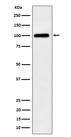 1 - Anti-Desmocollin 1 Rabbit Monoclonal Antibody ABO16685