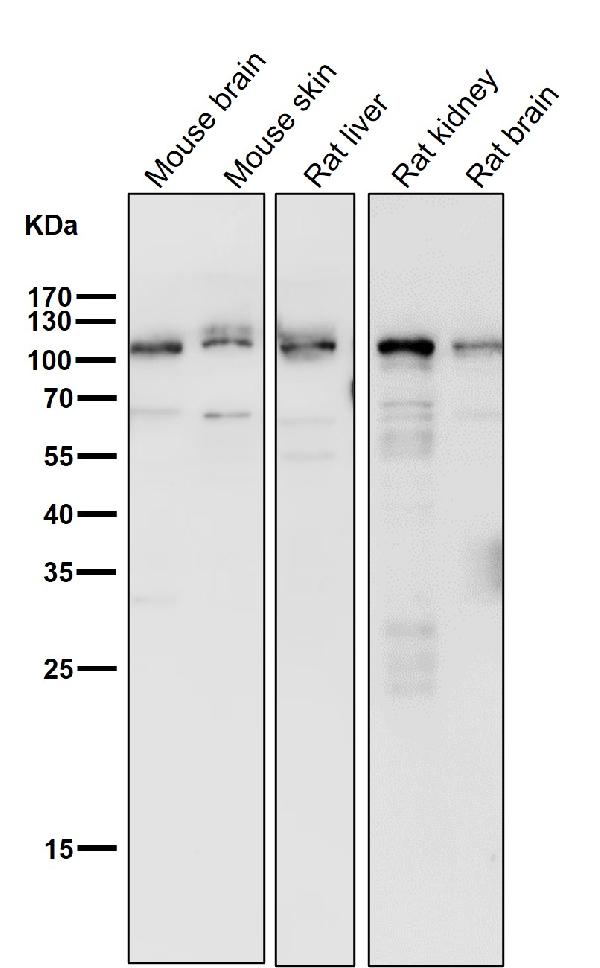 1 - Anti-Desmocollin 1 Rabbit Monoclonal Antibody ABO16685