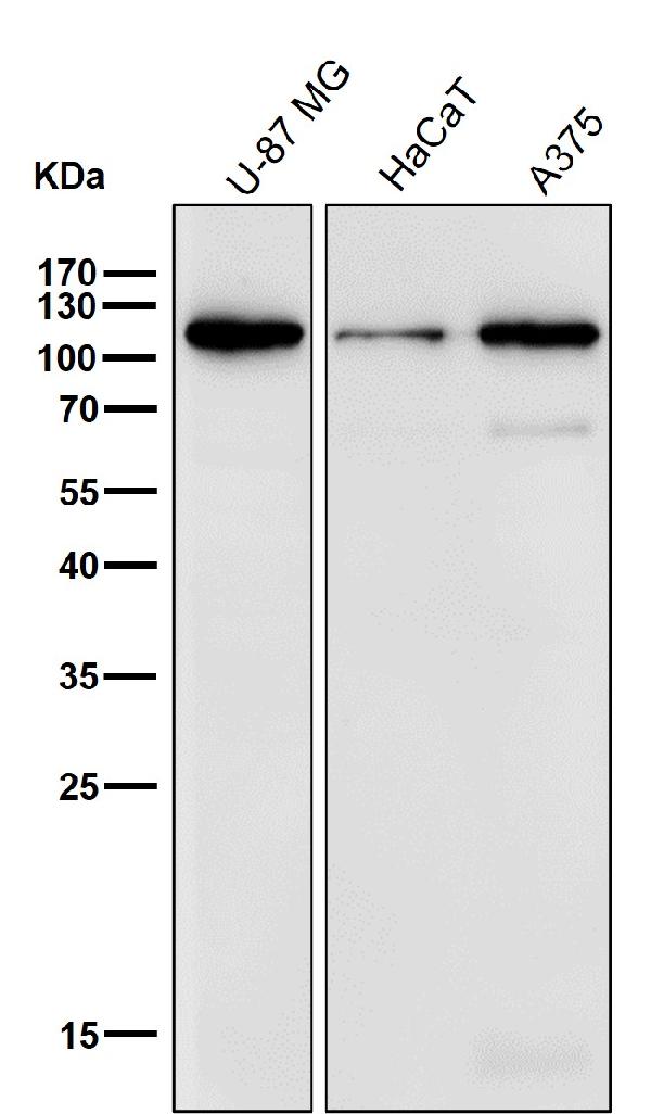 1 - Anti-Desmocollin 1 Rabbit Monoclonal Antibody ABO16685