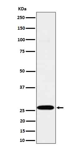 1 - Anti-C1QA Rabbit Monoclonal Antibody ABO16686