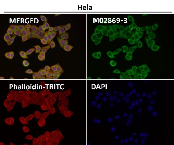 1 - Anti-CD223 Rabbit Monoclonal Antibody ABO16687