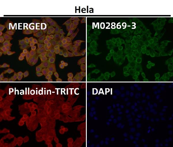 1 - Anti-CD223 Rabbit Monoclonal Antibody ABO16687