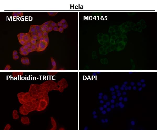 1 - Anti-CABP Rabbit Monoclonal Antibody ABO16689