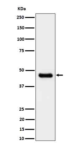 1 - Anti-CABP Rabbit Monoclonal Antibody ABO16689