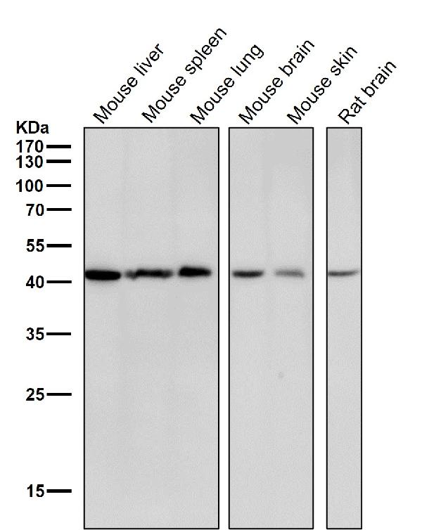 1 - Anti-CABP Rabbit Monoclonal Antibody ABO16689