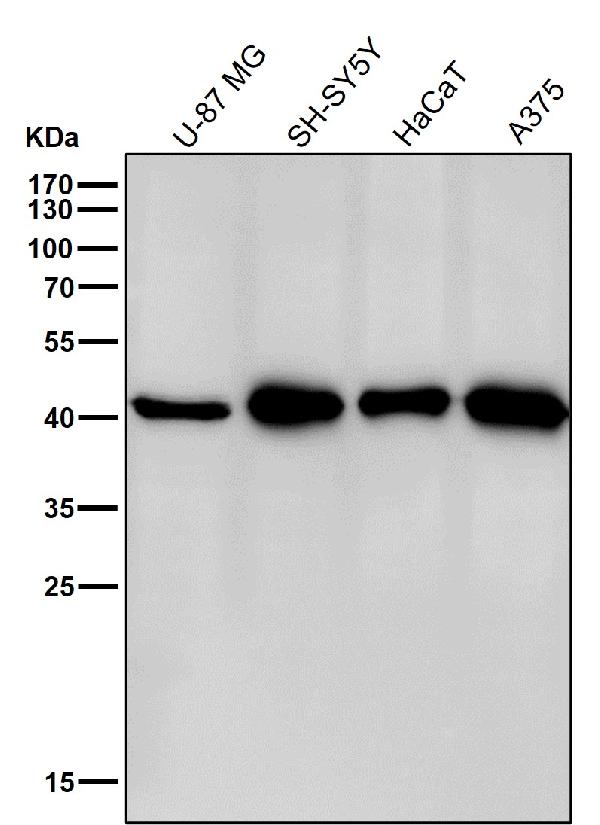 1 - Anti-CABP Rabbit Monoclonal Antibody ABO16689