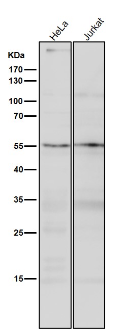 1 - Anti-SEC62 Rabbit Monoclonal Antibody ABO16693
