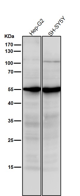 1 - Anti-SEC62 Rabbit Monoclonal Antibody ABO16693