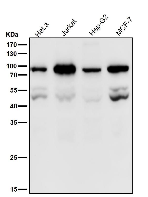1 - Anti-PSIP1 / LEDGF Rabbit Monoclonal Antibody ABO16695