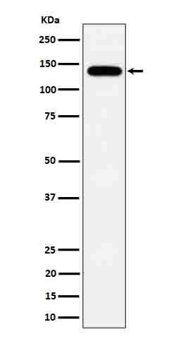 1 - Anti-Tripeptidyl peptidase II Rabbit Monoclonal Antibody ABO16700