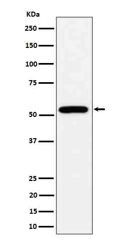 1 - Anti-ALDH2 Rabbit Monoclonal Antibody ABO16701