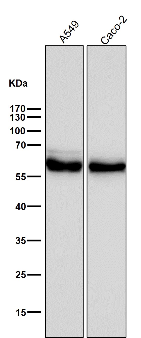 1 - Anti-ALDH2 Rabbit Monoclonal Antibody ABO16701