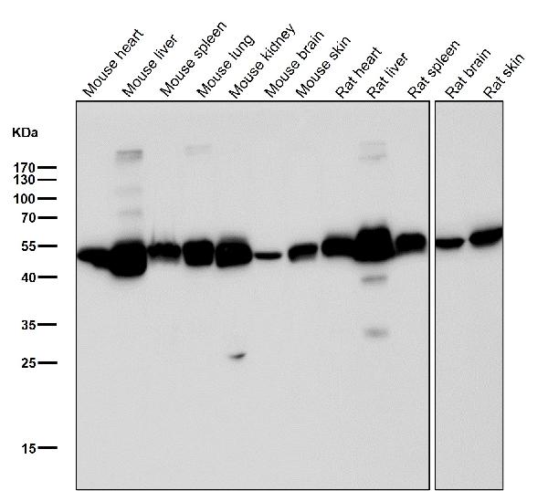 1 - Anti-ALDH2 Rabbit Monoclonal Antibody ABO16701