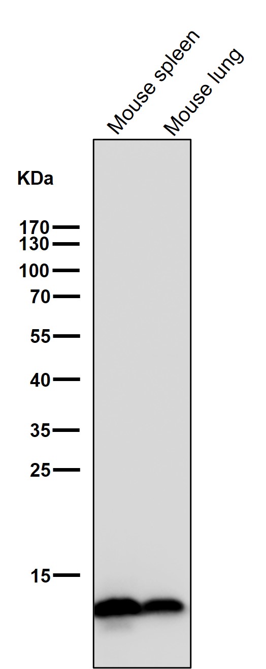 1 - Anti-Histone H2B (crotonyl K12) Rabbit Monoclonal Antibody ABO16702