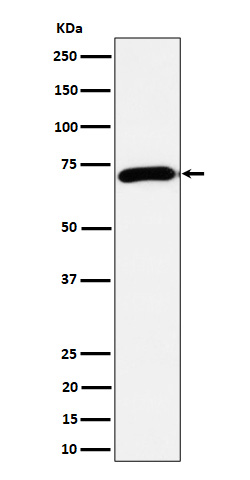 1 - Anti-Choline Acetyltransferase Rabbit Monoclonal Antibody ABO16704