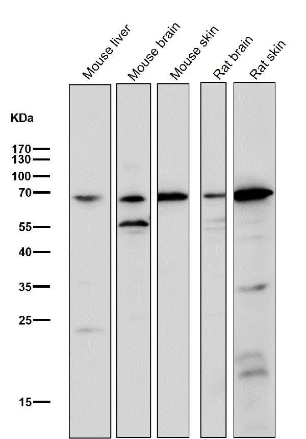 1 - Anti-Choline Acetyltransferase Rabbit Monoclonal Antibody ABO16704