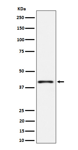 1 - Anti-Phospho-p38 (T180) Rabbit Monoclonal Antibody ABO16705